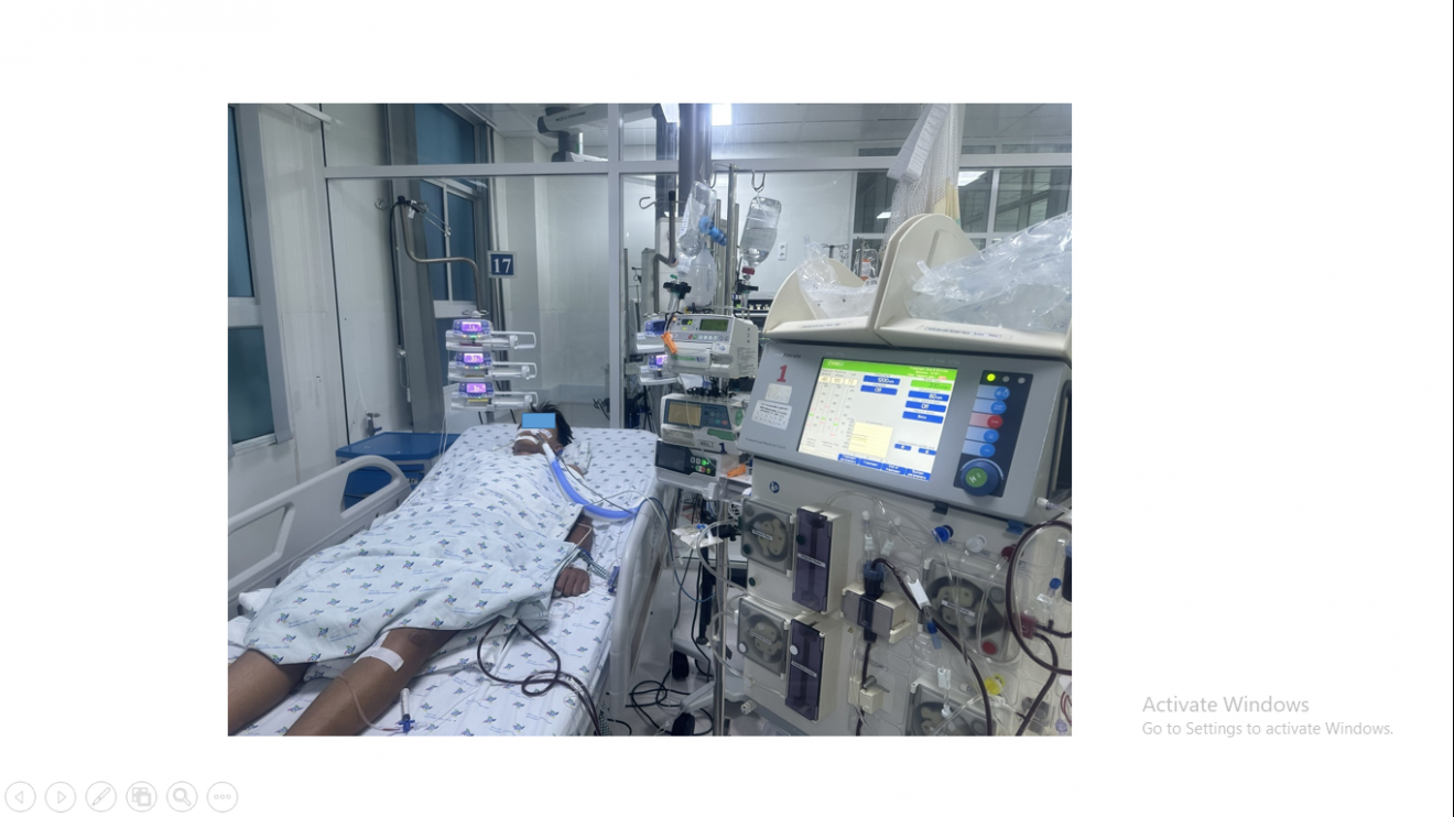 Biến chứng hiếm gặp của căn bệnh do muỗi cắn, thế giới chỉ c&oacute; 70 ca- Ảnh 1.