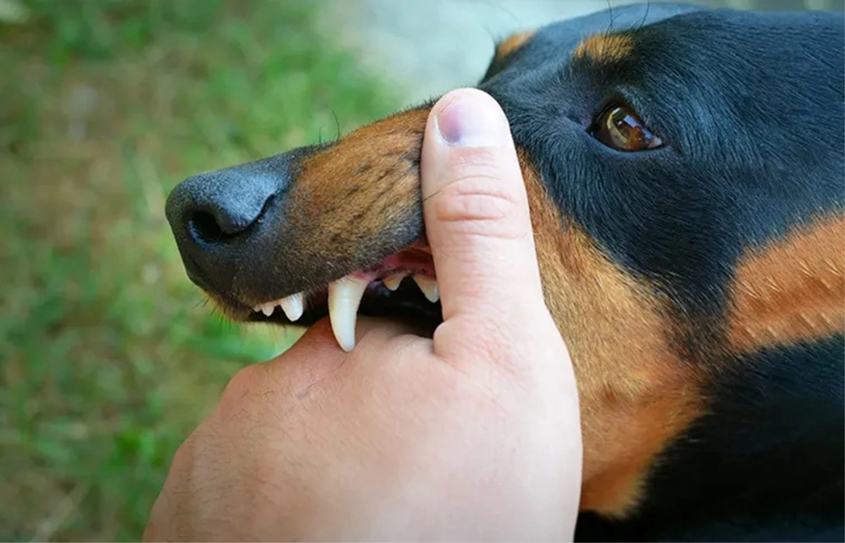 Người đ&agrave;n &ocirc;ng 51 tuổi tử thương t&acirc;m sau khi bị ch&oacute; "lạ" cắn- Ảnh 1.