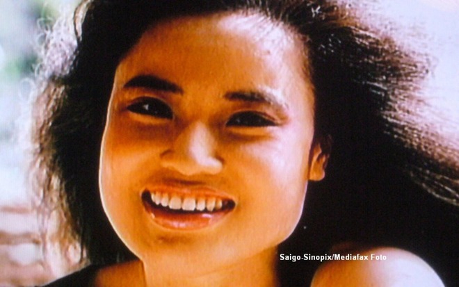 "Thảm họa thẩm mỹ" cuồng loạn tự ti&ecirc;m dầu ăn v&agrave;o mặt, từ mỹ nh&acirc;n xinh đẹp cuối đời ra đi trong đau đớn- Ảnh 3.