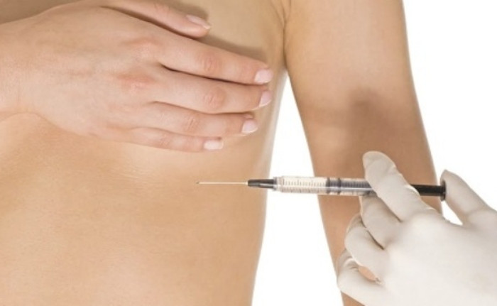 Ti&ecirc;m filler n&acirc;ng ngực đ&oacute;n Tết, người phụ nữ nhập viện v&igrave; &aacute;p xe nặng- Ảnh 1.