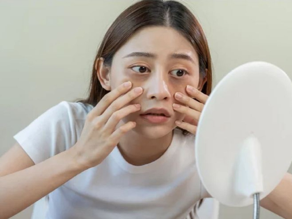 Những bất thường ở v&ugrave;ng đầu cảnh b&aacute;o ung thư phổi? Nếu c&oacute; 3 dấu hiệu n&agrave;y h&atilde;y đi kh&aacute;m c&agrave;ng sớm c&agrave;ng tốt!- Ảnh 4.