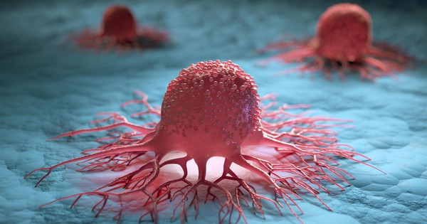 Nữ bác sĩ chiến thắng ung thư: “Ung thư không phải là nỗi sợ nếu bạn làm 4 điều này mỗi ngày”