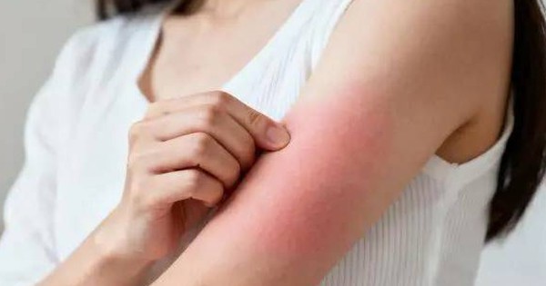 Đừng đợi đến khi phù nề mới đi khám! Bác sĩ chỉ ra 3 dấu hiệu sớm của bệnh thận mà 90% người bỏ qua