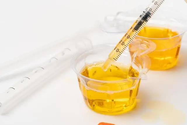 Đừng đợi đến khi phù nề mới đi khám! Bác sĩ chỉ ra 3 dấu hiệu sớm của bệnh thận mà 90% người bỏ qua- Ảnh 2.