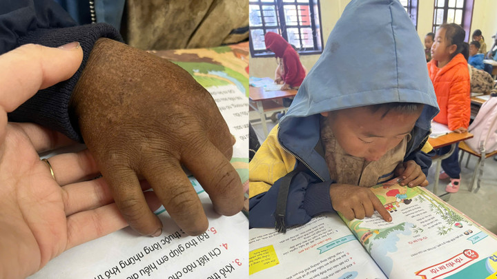 Hình ảnh bàn tay nứt nẻ của cậu bé 8 tuổi vùng cao khiến triệu người nghẹn lại- Ảnh 1.