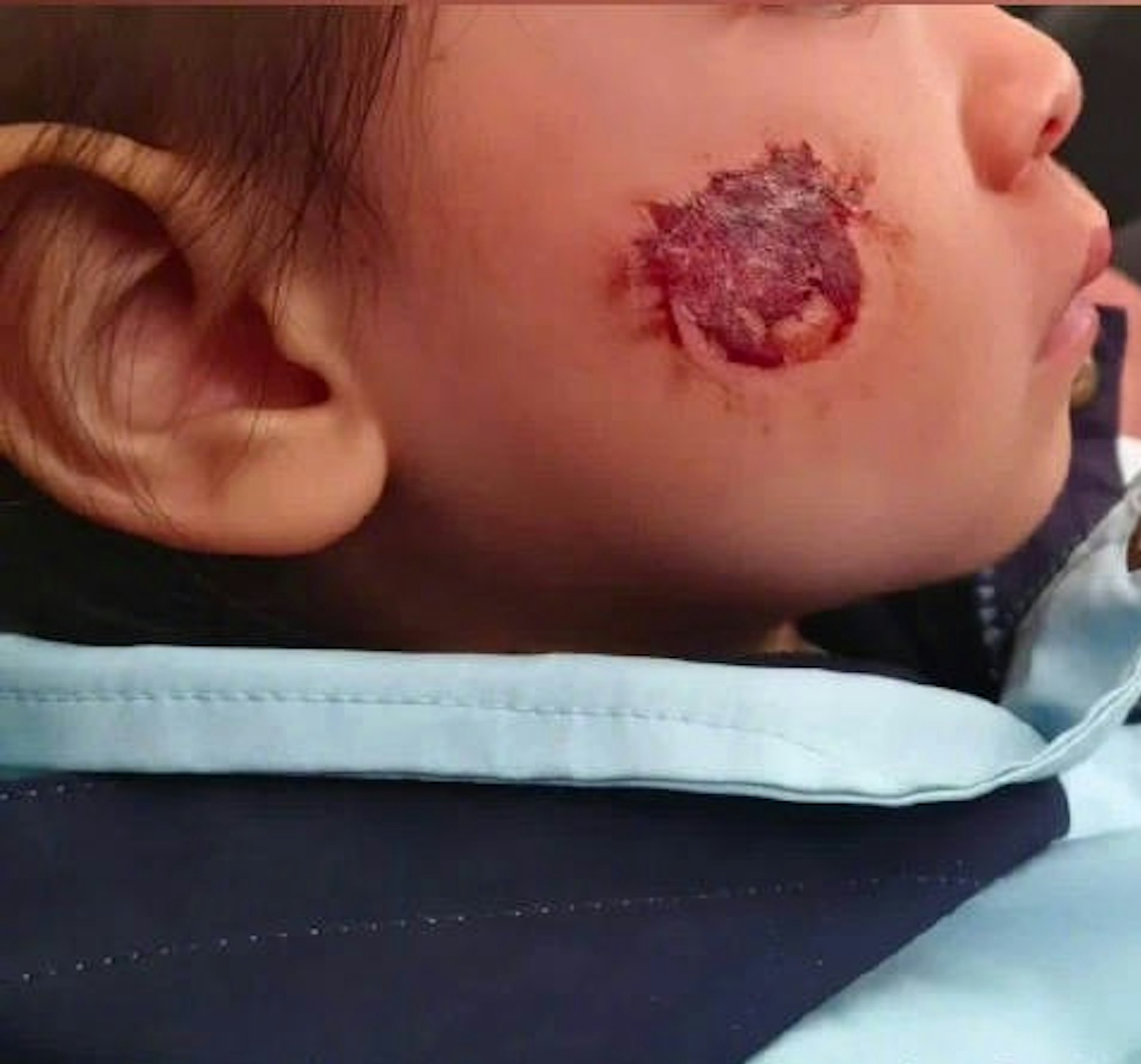 Bé gái 3 tuổi bị bỏng rộp cả mặt vì “miếng dán đồ chơi”: Nhiều đồ chơi hot trên mạng tuyệt đối không mua- Ảnh 1. Bé gái 3 tuổi bị bỏng rộp cả mặt vì “miếng dán đồ chơi”: Nhiều đồ chơi hot trên mạng tuyệt đối không mua- Ảnh 1.