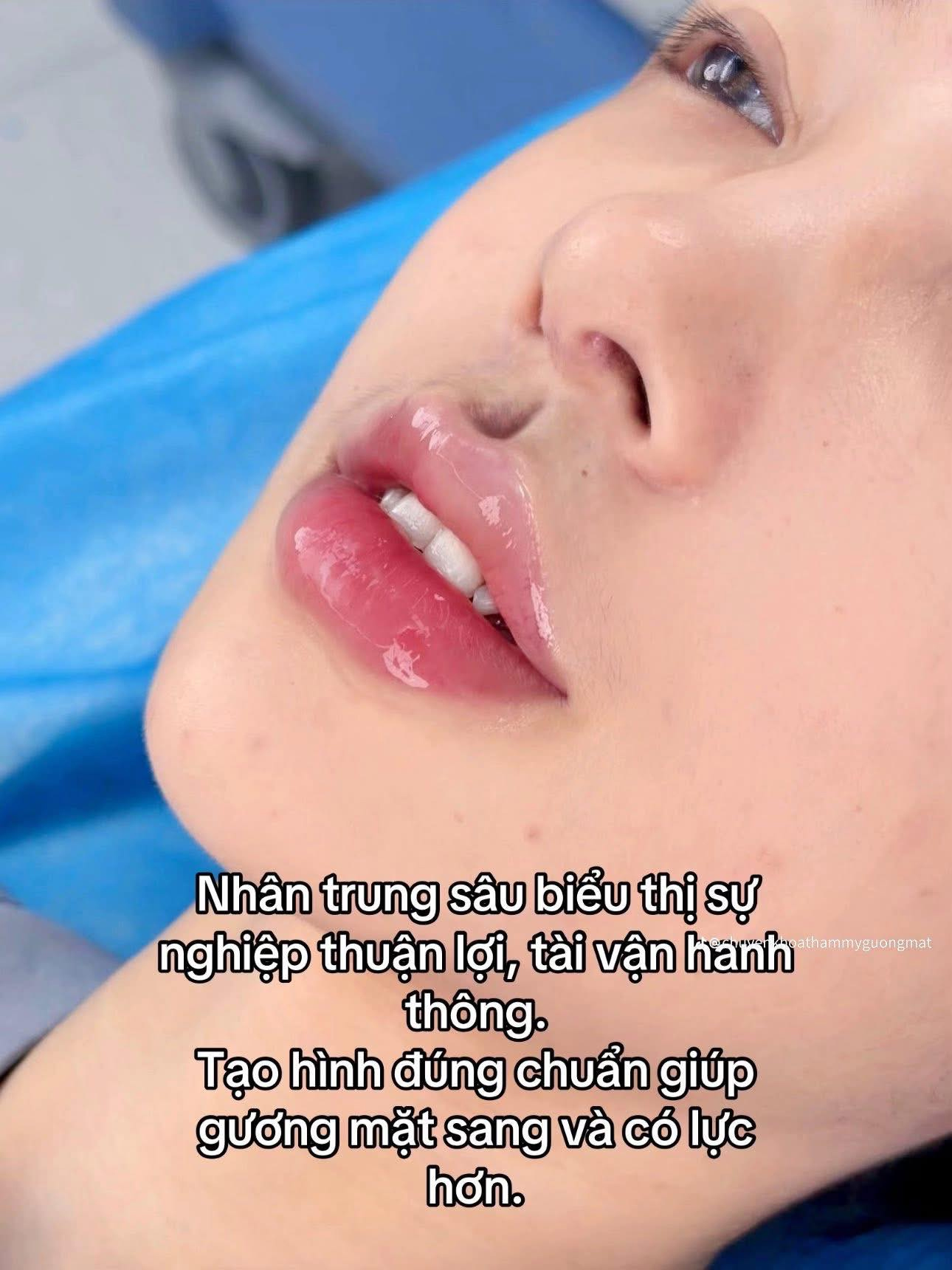 Nhân trung giọt nước chuẩn Trung Hoa khiến chị em phát sốt, người khen kẻ chê "chắc hứng nước luôn được"- Ảnh 3.
