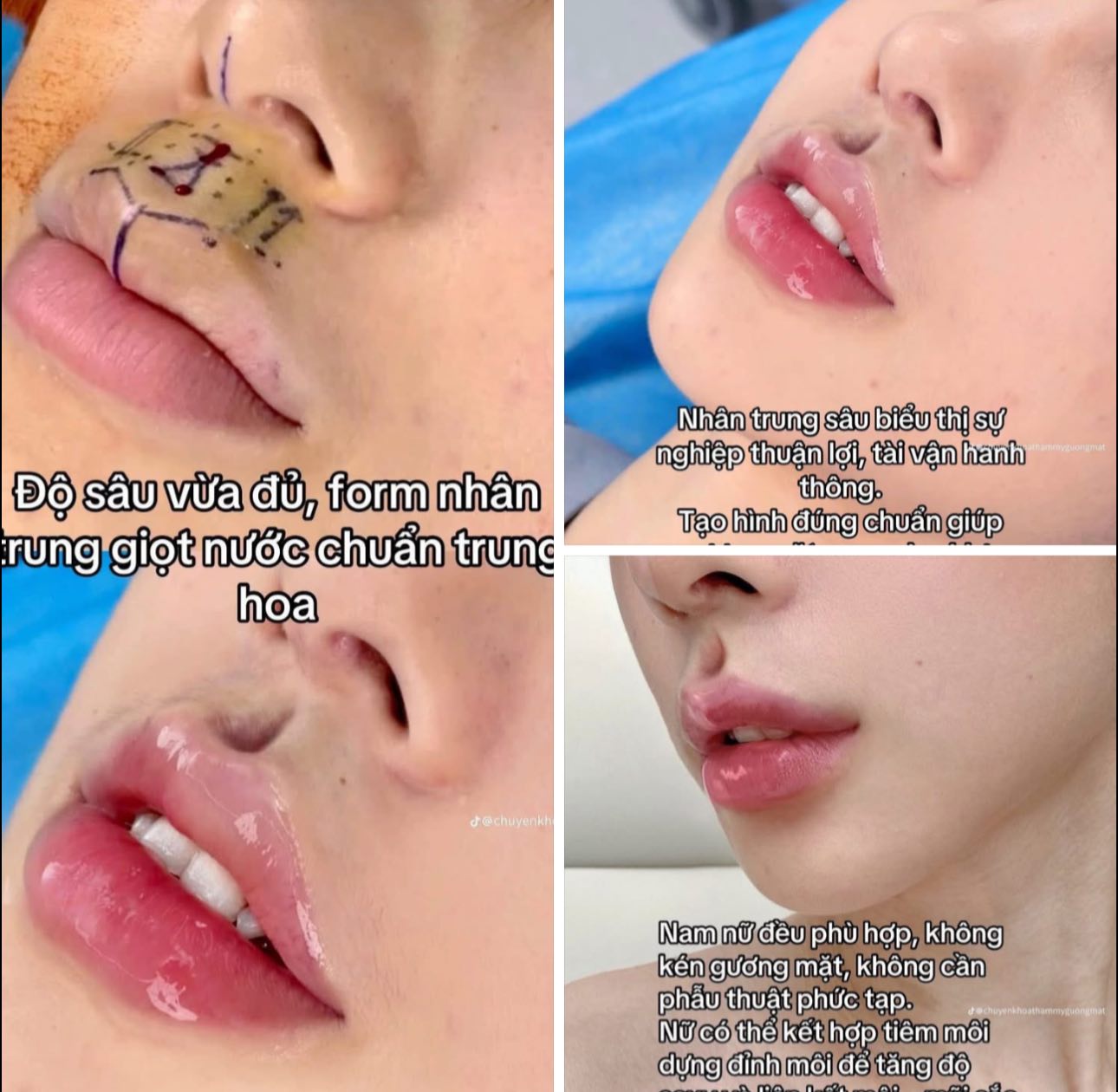 Nhân trung giọt nước chuẩn Trung Hoa khiến chị em phát sốt, người khen kẻ chê "chắc hứng nước luôn được"- Ảnh 2.