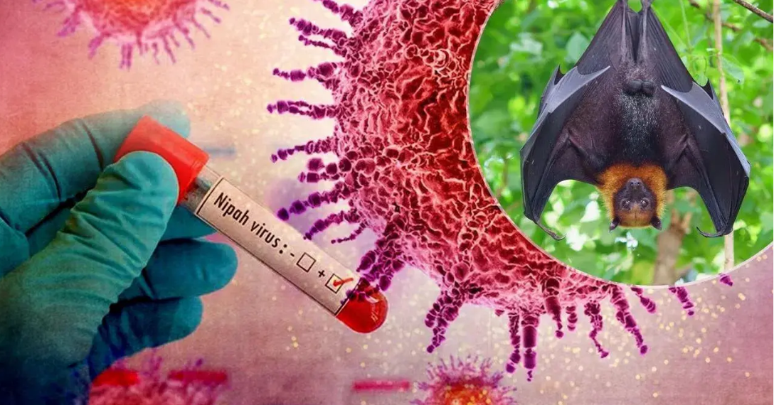 3 bệnh truyền nhiễm được Bộ Y tế bổ sung vào danh mục nhóm A - “bệnh cần giám sát chặt”: Nguy hiểm thế nào?- Ảnh 1. 3 bệnh truyền nhiễm được Bộ Y tế bổ sung vào danh mục nhóm A - “bệnh cần giám sát chặt”: Nguy hiểm thế nào?- Ảnh 1.