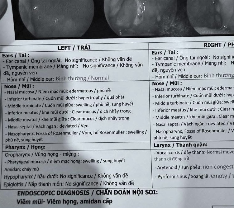 Chính xác thì Soobin đang bị gì?- Ảnh 3.