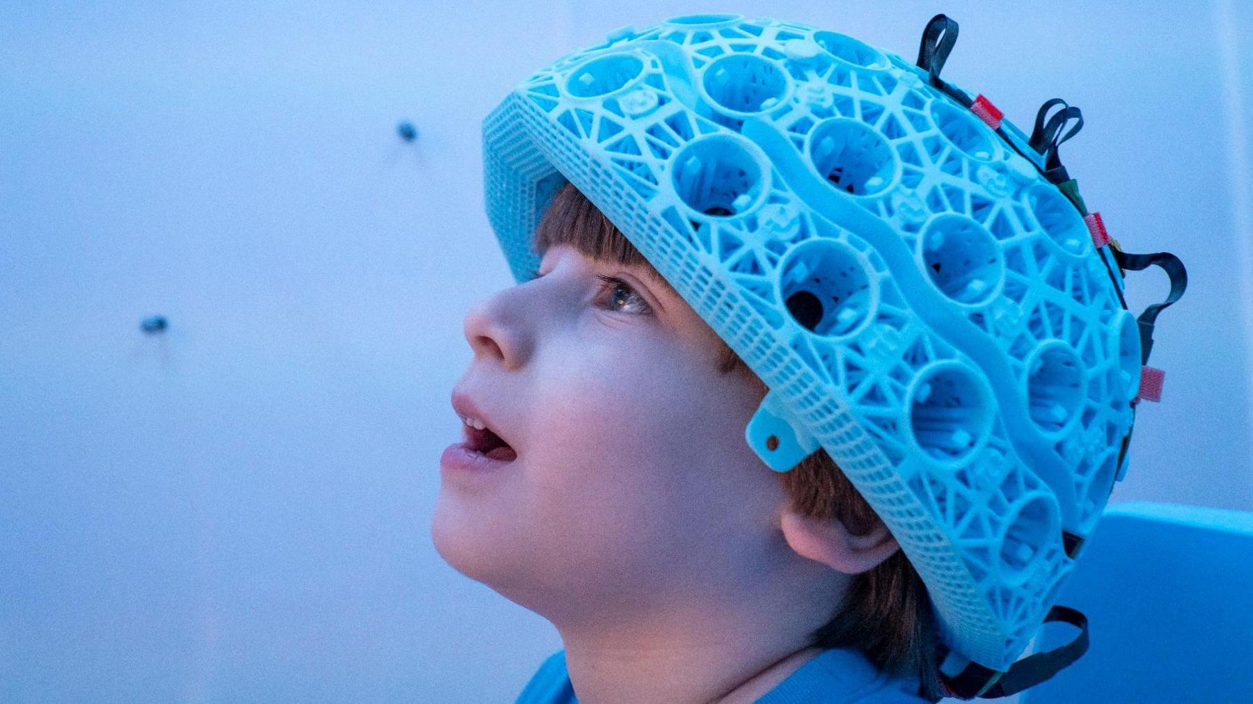 C&aacute;c nh&agrave; khoa học đ&atilde; đưa ra một cảnh b&aacute;o khẩn cấp sau khi 250.000 bộ n&atilde;o được 