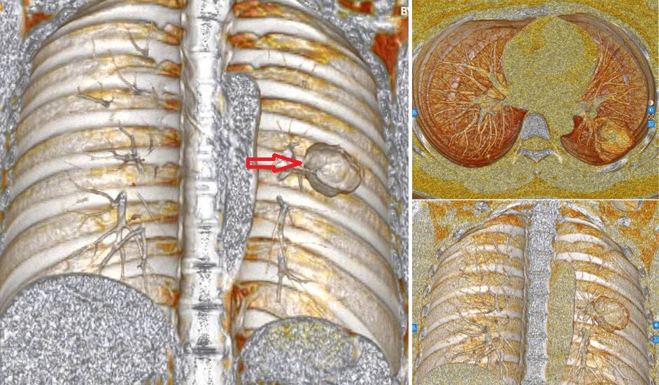X&eacute;t nghiệm c&oacute; chỉ số mang thai, c&ocirc; g&aacute;i ngỡ ng&agrave;ng khi &ldquo;thủ phạm&rdquo; l&agrave; ung thư tạo triệu chứng đ&aacute;nh lừa- Ảnh 1.