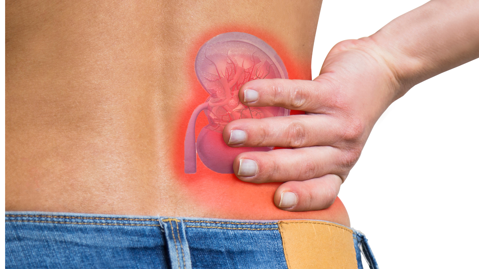 Người đàn ông 32 tuổi phát hiện ung thư thận nhờ làm 1 việc vào tháng 9- Ảnh 3. Người đàn ông 32 tuổi phát hiện ung thư thận nhờ làm 1 việc vào tháng 9- Ảnh 3.