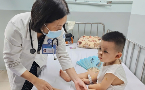 1 tuần TPHCM có hơn cả ngàn ca mắc tay chân miệng, Sở Y tế nói gì ?