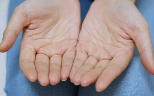 Nam giới mắc bệnh thận, thường xuyên ra mồ hôi ở 5 vị trí này