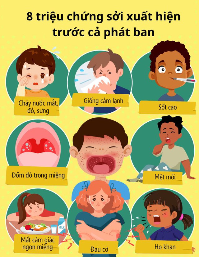 8 dấu hiệu ban đầu của "căn bệnh dễ lây lan nhất thế giới": Xuất hiện TRƯỚC cả khi phát ban, trẻ dưới 5 tuổi có nguy cơ cao nhất- Ảnh 3.