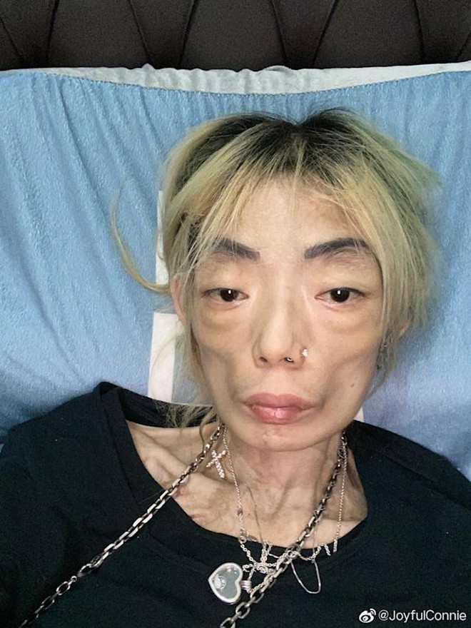 Người mẫu H. Người mẫu H.