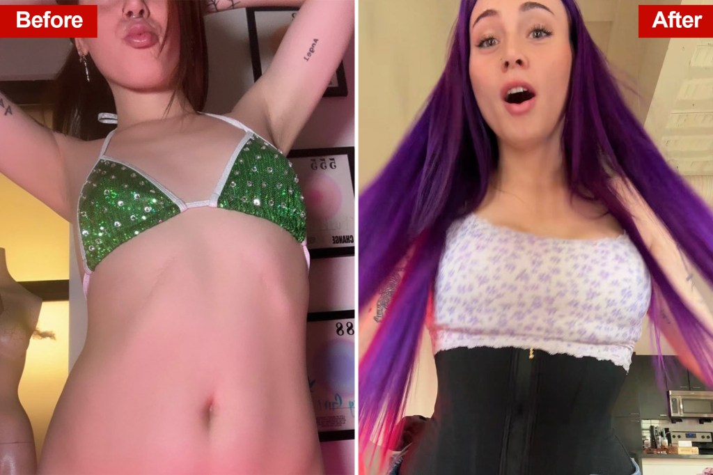 Cô gái 28 tuổi chi 362 triệu, cắt 6 xương sườn để có vòng eo con kiến - trào lưu thẩm mỹ kinh hoàng quay trở lại- Ảnh 1.