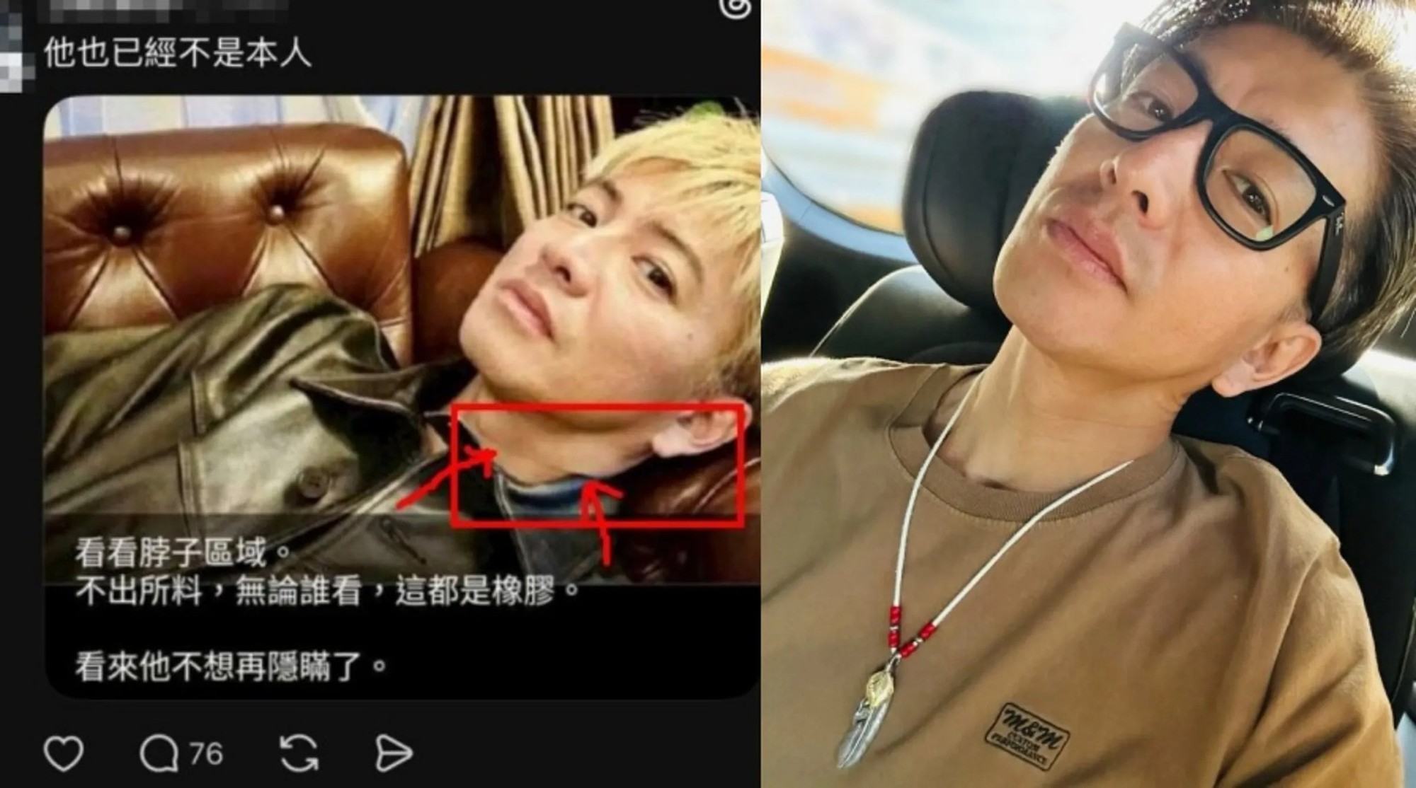 Chuyện khó tin về nam thần số một Nhật Bản- Ảnh 5.