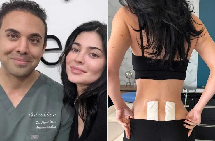 Kylie Jenner đang phải chữa bệnh gì?- Ảnh 3.