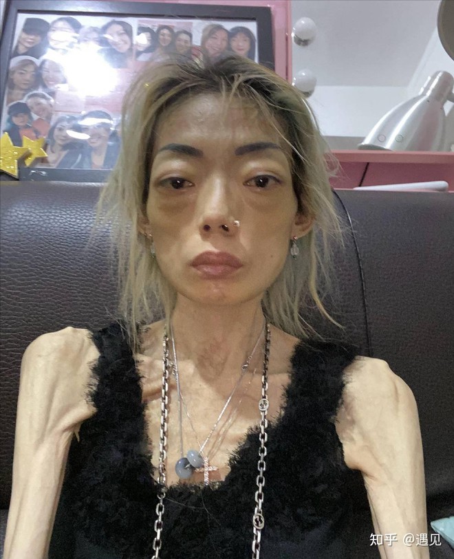 Người mẫu H. Người mẫu H.