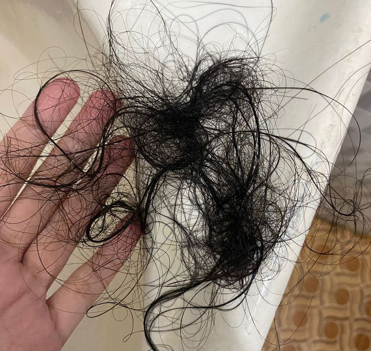 7 thay đổi sớm nhất về ngoại hình khi ung thư tuyến giáp "ghé thăm", nhiều người... mới nghe lần đầu- Ảnh 3.