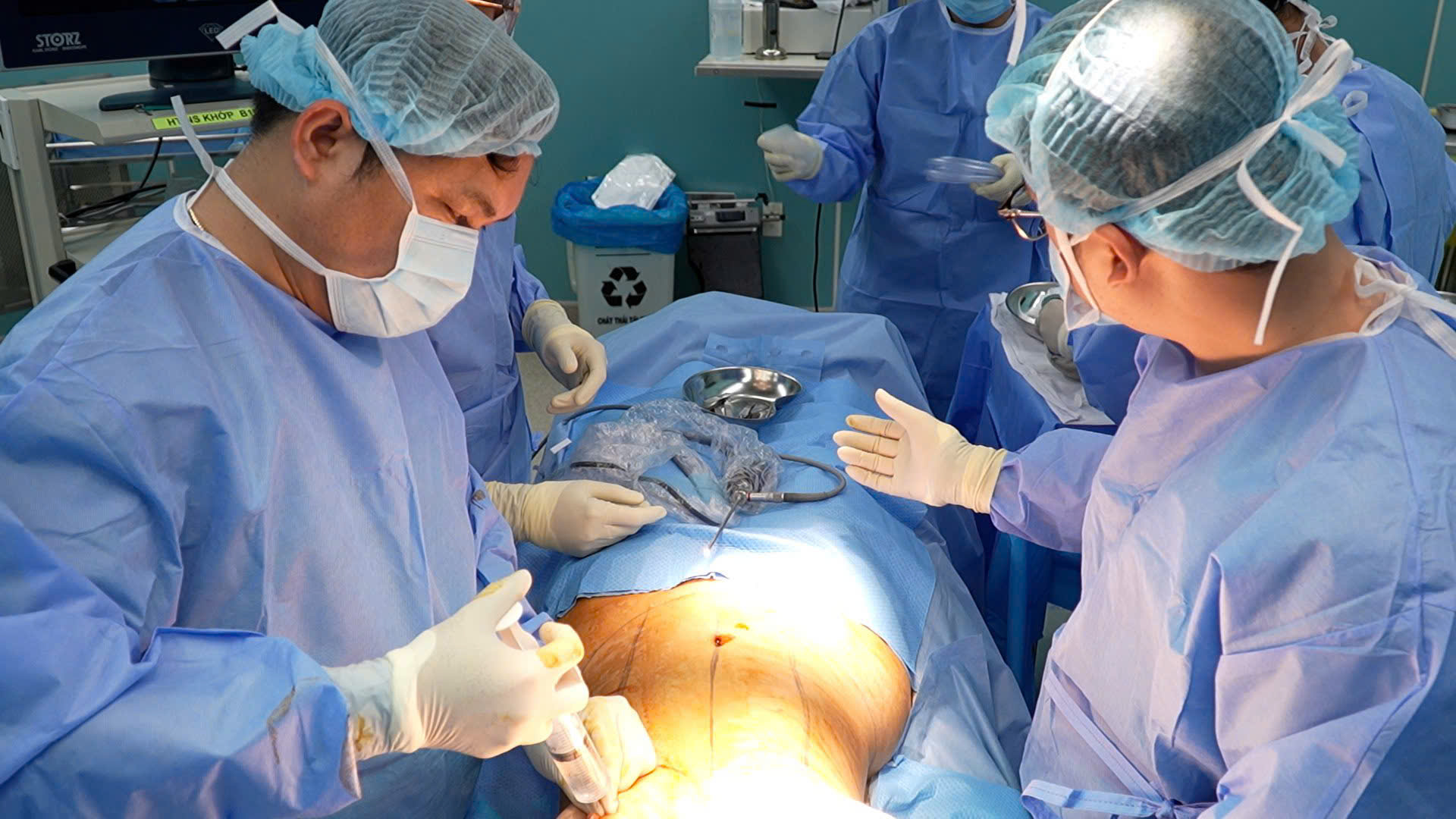 Không chuẩn bị đủ những điều này, bác sĩ khuyên đừng phẫu thuật thẩm mỹ- Ảnh 2.