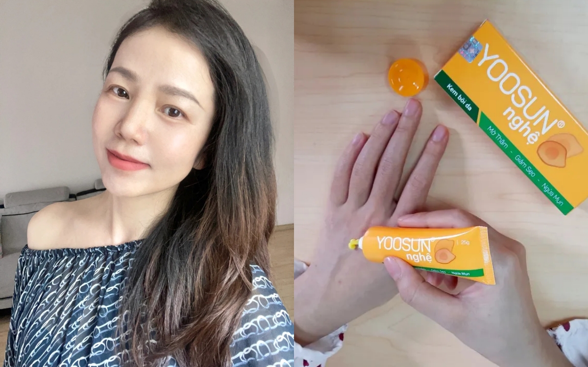 5 sản phẩm chiết xuất nghệ "made in Vietnam" giá rẻ bèo và chất lượng cực mê- Ảnh 1.