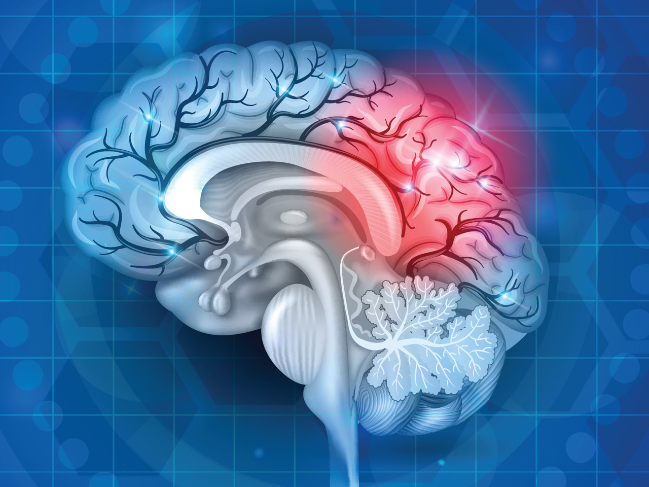 Ngày càng có nhiều người bị đột quỵ: Chuyên gia gọi tên 10 “thủ phạm” hàng đầu- Ảnh 1. Ngày càng có nhiều người bị đột quỵ: Chuyên gia gọi tên 10 “thủ phạm” hàng đầu- Ảnh 1.