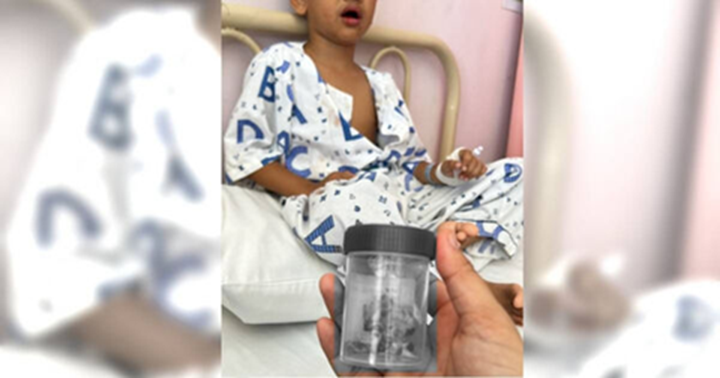 Bé trai 12 tuổi mất 12 chiếc răng 1 lúc vì thói quen nhiều trẻ mắc phải- Ảnh 1.