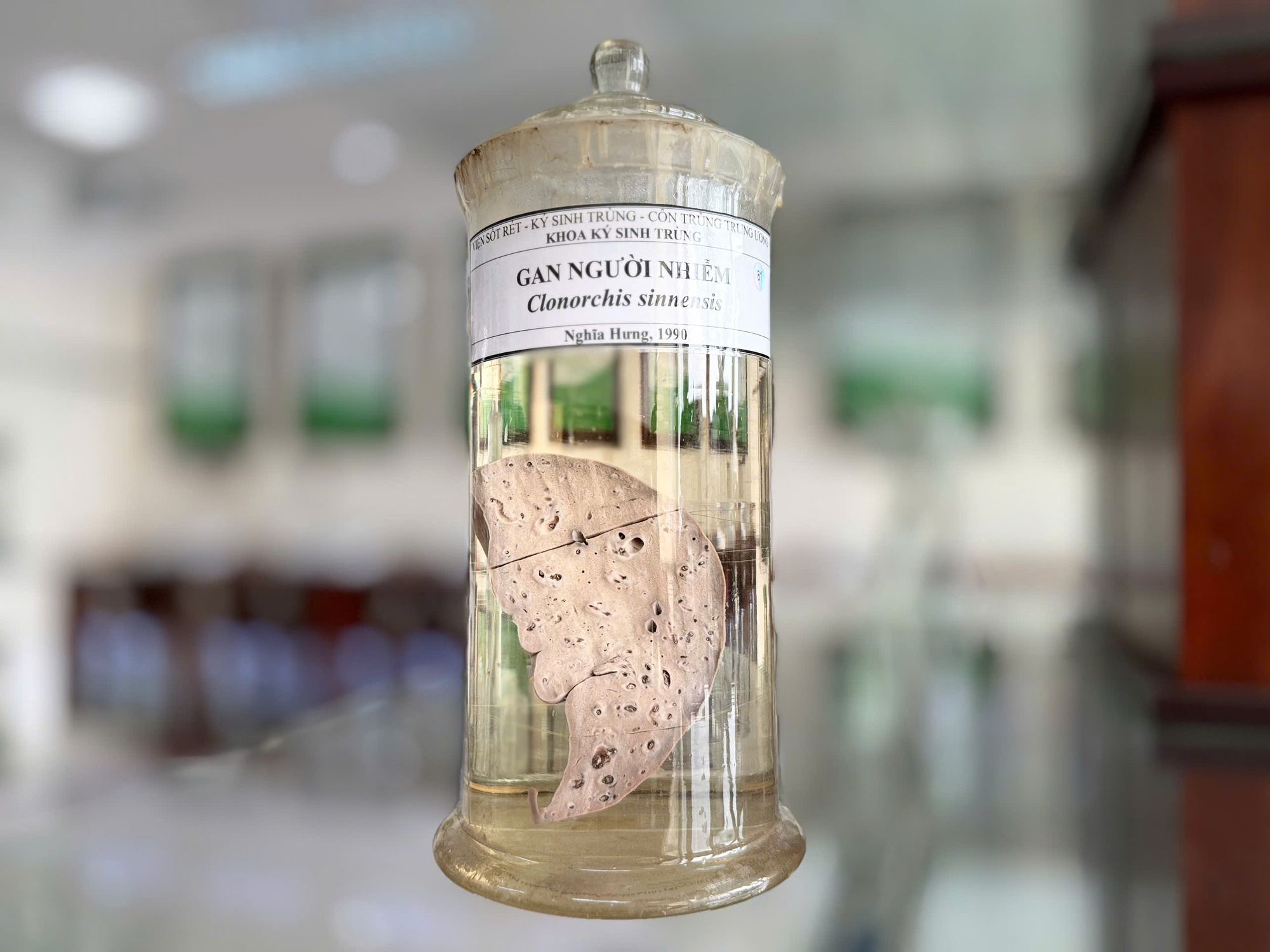 Món ăn tưởng tốt cho gan hóa ra ngấm ngầm tàn phá, "ăn mòn” cơ quan này- Ảnh 2.