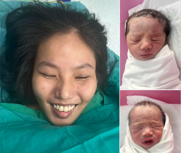 Mẹ bầu nuôi tạm bàn tay ở cẳng chân được nối trở lại đã sinh con an toàn