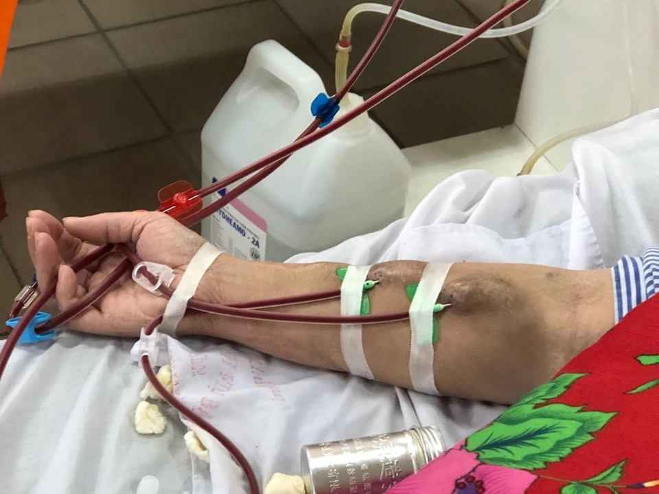 20 tuổi đã phải chạy thận cả đời, bác sĩ chỉ biết thốt lên đau xót: 