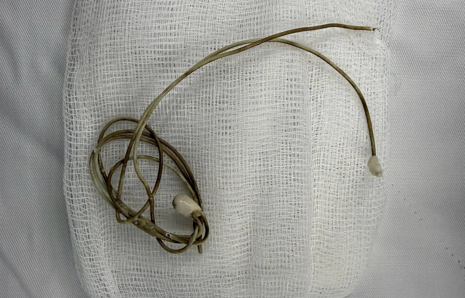 Bắt chước trên mạng, chàng trai nhét dây sạc điện thoại vào vùng kín- Ảnh 2.