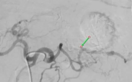 Cầm máu thành công ca ung thư dạ dày biến chứng- Ảnh 1.