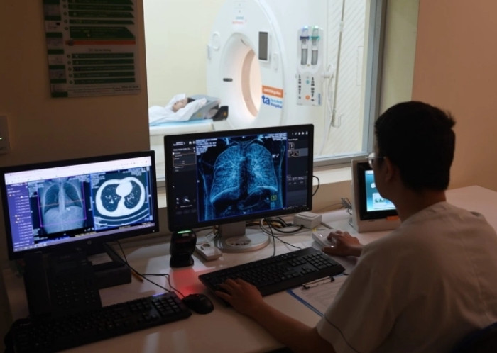 Ô nhiễm không khí có gây ung thư?- Ảnh 1.