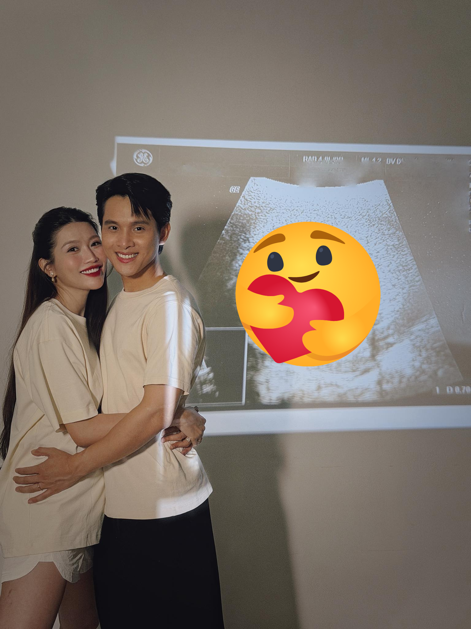 Chế Nguyễn Quỳnh Châu mang thai con đầu lòng sau hơn 1 tháng đám cưới- Ảnh 1.