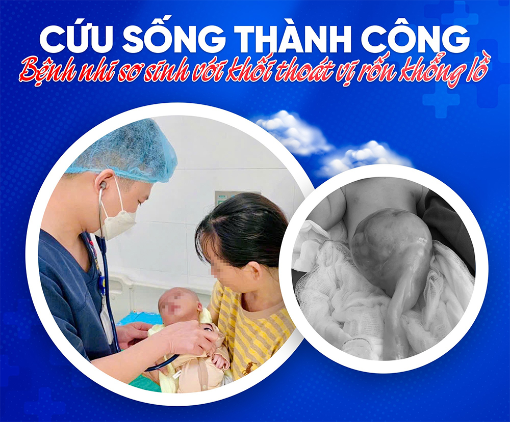 Hành trình 71 ngày giành lại sự sống cho trẻ sơ sinh mang khối thoát vị rốn Hành trình 71 ngày giành lại sự sống cho trẻ sơ sinh mang khối thoát vị rốn