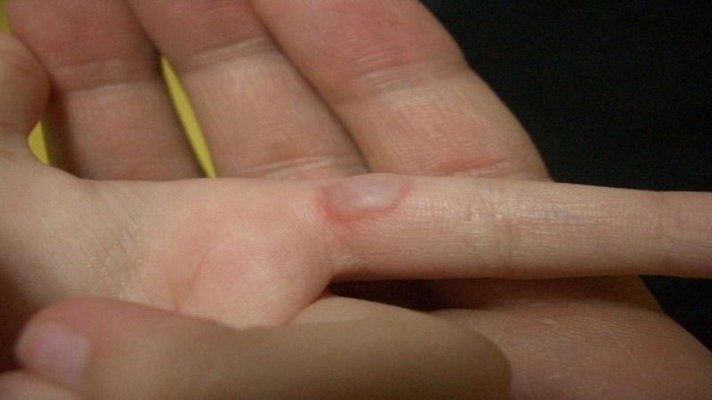 Cả đời dùng ấm siêu tốc, ai cũng nghĩ nó vô hại: Nào ngờ tiềm ẩn 4 rủi ro đe dọa sức khỏe- Ảnh 3.