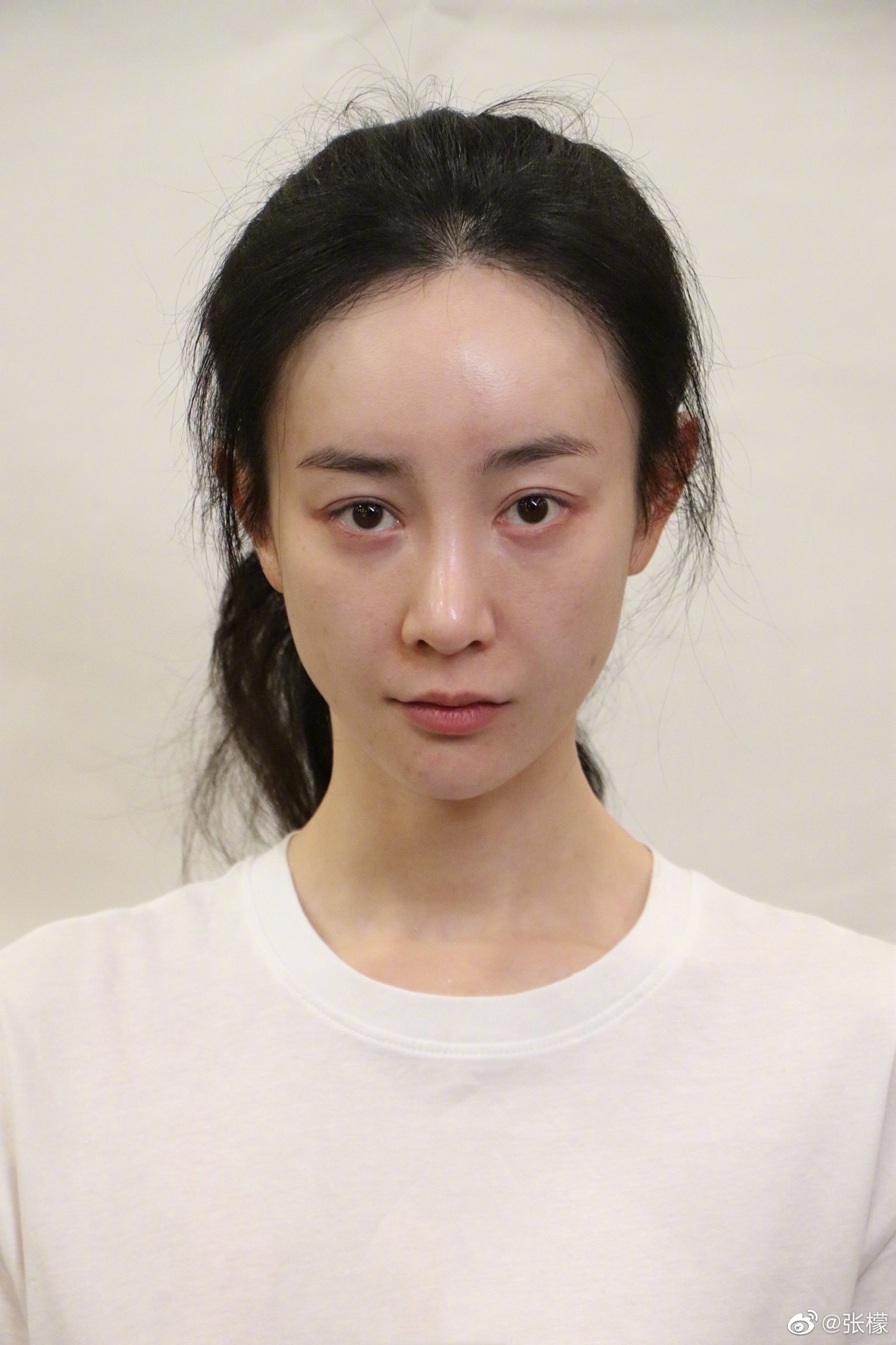 Tiểu tam bị huỷ hoại toàn bộ nhan sắc giờ sống ra sao?- Ảnh 6. Tiểu tam bị huỷ hoại toàn bộ nhan sắc giờ sống ra sao?- Ảnh 6.