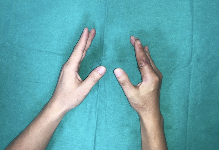 Ngón tay thủy thủ 'sống lại' sau 25 giờ đứt rời giữa tâm bão- Ảnh 3.