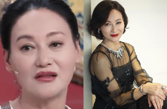 Quốc bảo nhan sắc showbiz lộ mặt mũi biến dạng méo mó sau gần 90 mũi khâu định mệnh- Ảnh 2.