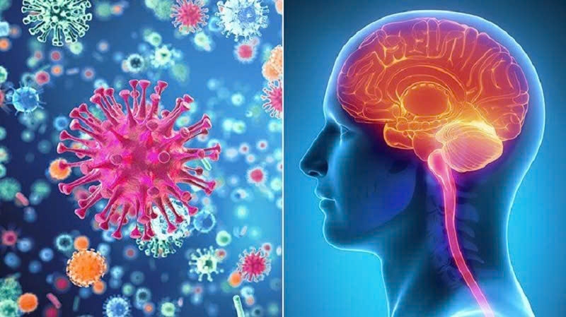 Bệnh viêm màng não mô cầu nguy hiểm như thế nào, dấu hiệu nhận biết ra sao?- Ảnh 1.