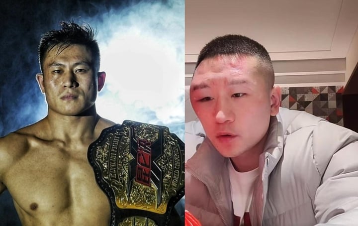 Thách thức nhà vô địch thế giới, võ sĩ Trung Quốc bị đánh sưng mặt- Ảnh 1.