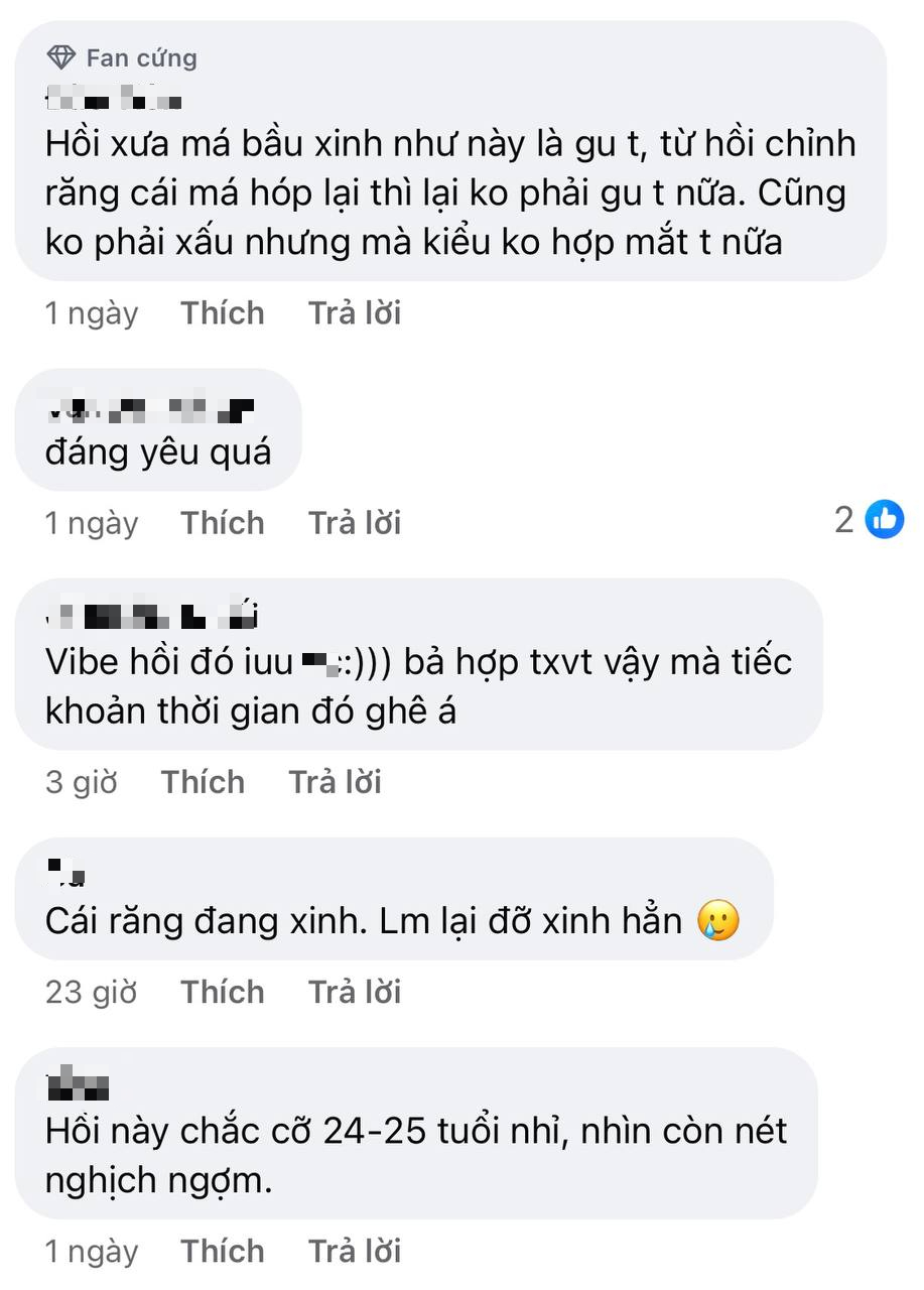 Đối thủ của Triệu Lộ Tư lộ ảnh 10 năm trước, so với hiện tại như "đổi mặt"- Ảnh 3.