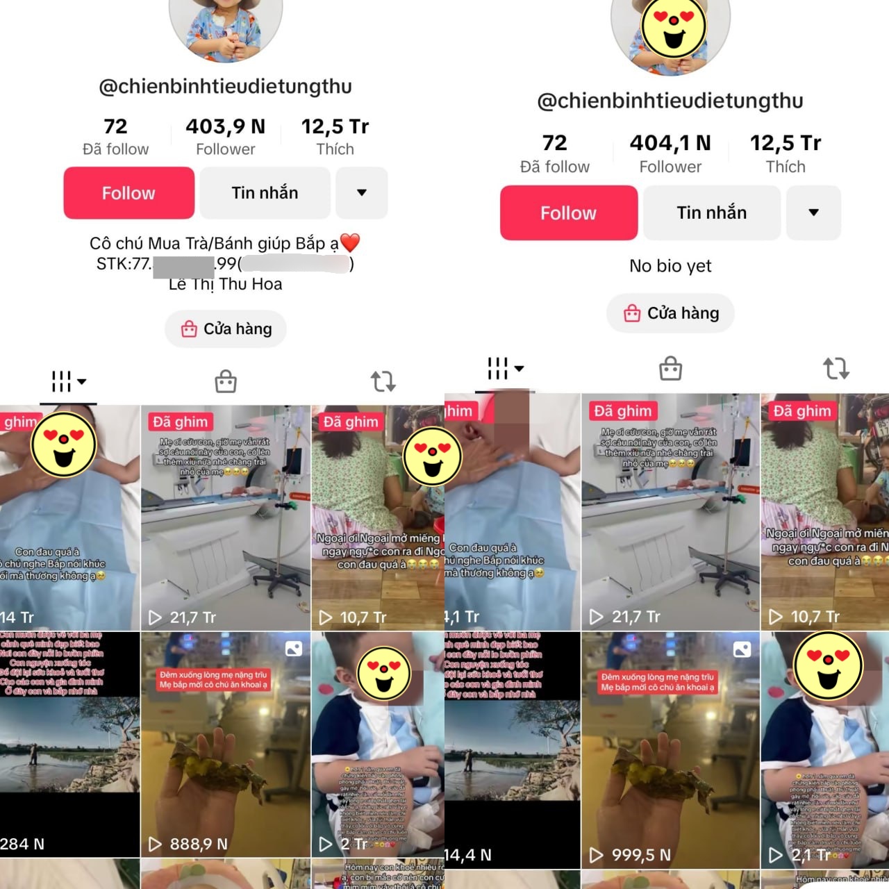 Mẹ bé Bắp bất ngờ 