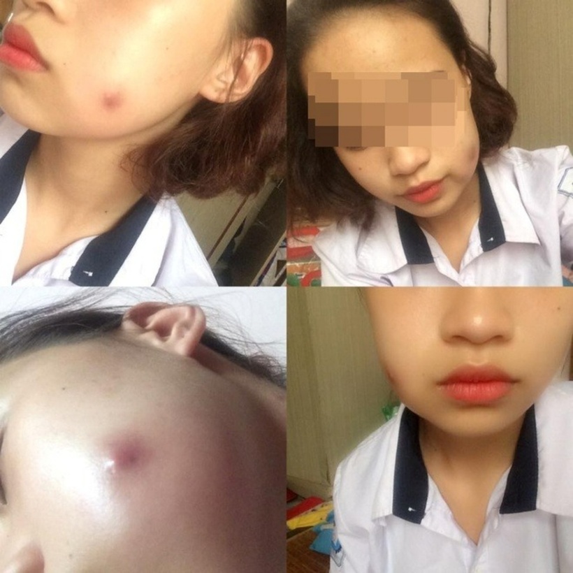 Bi h&agrave;i chuyện "dao k&eacute;o" đổi vận: Mắc bẫy l&agrave;m đẹp &ldquo;l&uacute;m đồng tiền đổi đời&rdquo;, c&ocirc; g&aacute;i nhận cặp m&aacute; &ldquo;ong đốt&rdquo;- Ảnh 2.