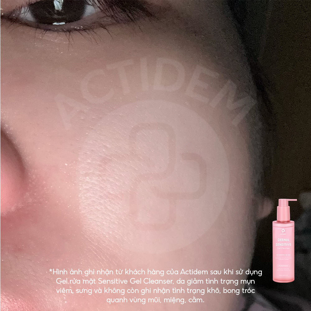 Gel rửa mặt Actidem Derma Sensitive đạt chuẩn châu Âu Dermatest dành cho da nhạy cảm được Beauty Blogger đánh giá cao- Ảnh 8.