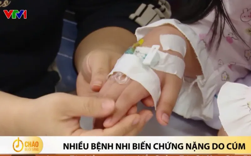 Nhiều bệnh nhi biến chứng nặng do cúm- Ảnh 1.