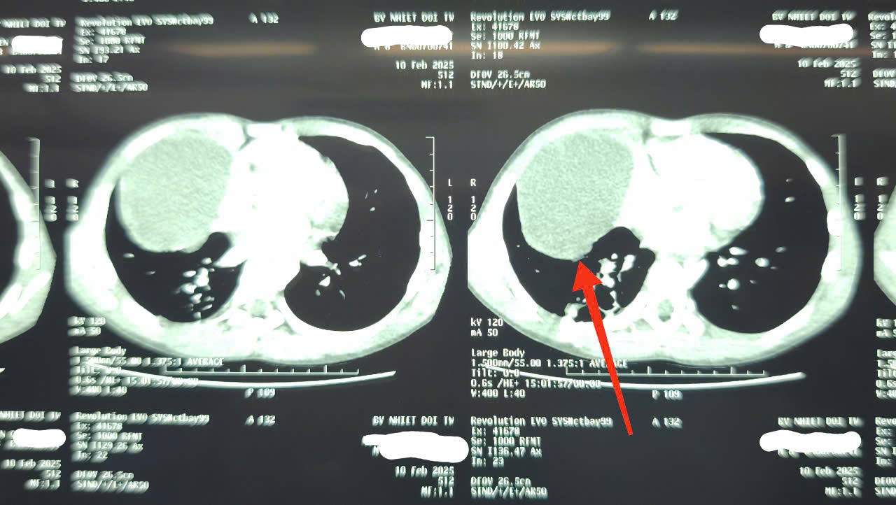 Hà Nội: Con trai bị bạn xô ngã, bố mẹ đưa đi khám và không tin nổi vào ảnh CT- Ảnh 1.